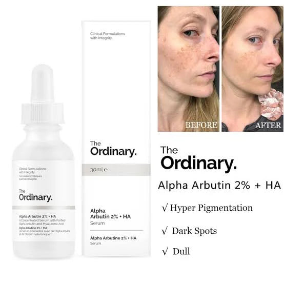 The Ordinary Alpha arbutin 2% + HA